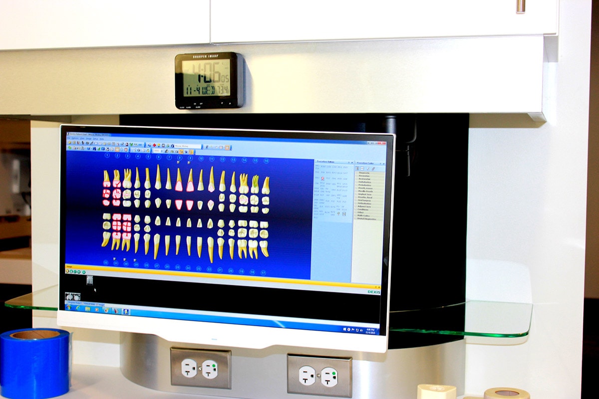 DEXIS digital dental charting software on monitor